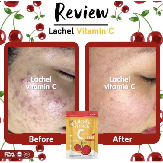 Jual Lachel Vitamin C Vit C 2 in 1 Shopee Indonesia