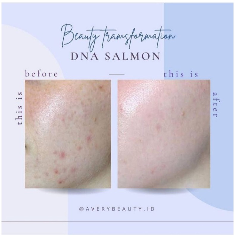 Jual Salmon DNA Injection Clapio Bright Cell Shopee Indonesia