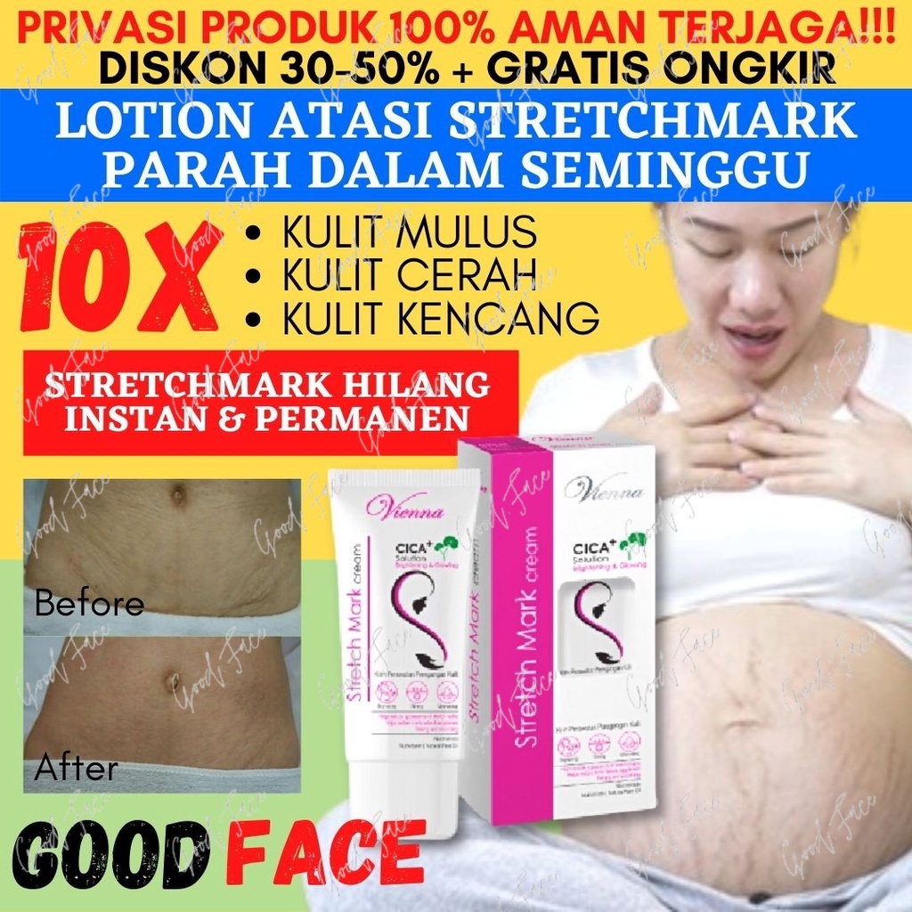 Jual PENGHILANG STRECHMARK VIENNA STRETCH MARK CREAM STRETCH MARK CREAM