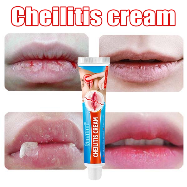 Jual Cheilitis cream obat bibir pecah dan kering Krim pelembab bibir