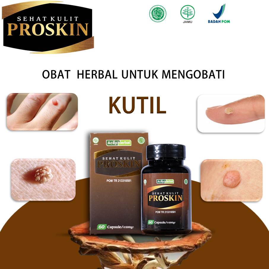 Herbal Medicine For Treat Warts, Kelamine, Caligata Water, Herpes