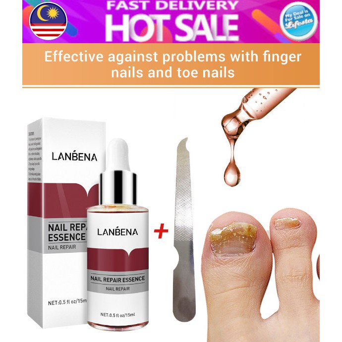 100 ORIGINAL LANBENA Nail Repair Essence Oils Serum Fungal Nail