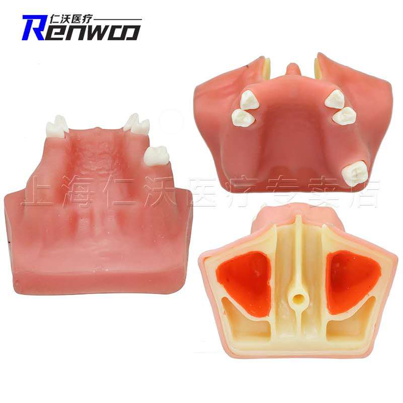 Maxillary Sinus Lifting Exercise teeth Model dental implant practice