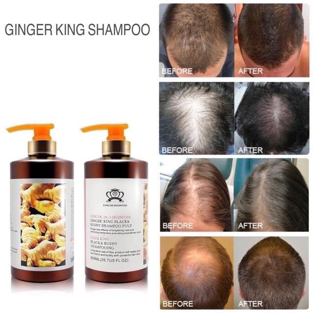 DR. HUISITER Ginger Black & Bushy Shampoo Pulp 800ml Shopee Malaysia