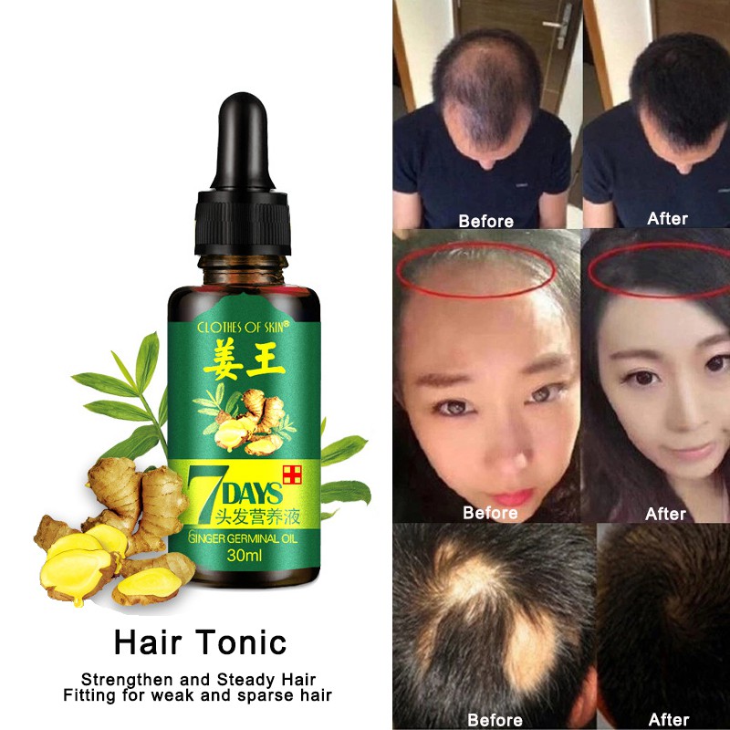 7 Days Ginger Germinal Oil Liquid Hair Tonic Hair Health Care Nourishing Nutrient Herbal Formula