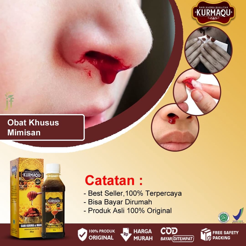 Mimisan Medicine, Nose Polip, Swelling, Ointment, Sinusitis