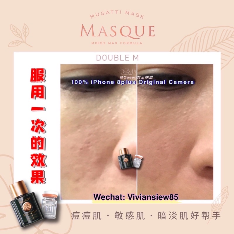 🔥新品💃Mugatti Mask 升级版 DoubleM 🎭 Professional Beauty Solution💦 Shopee