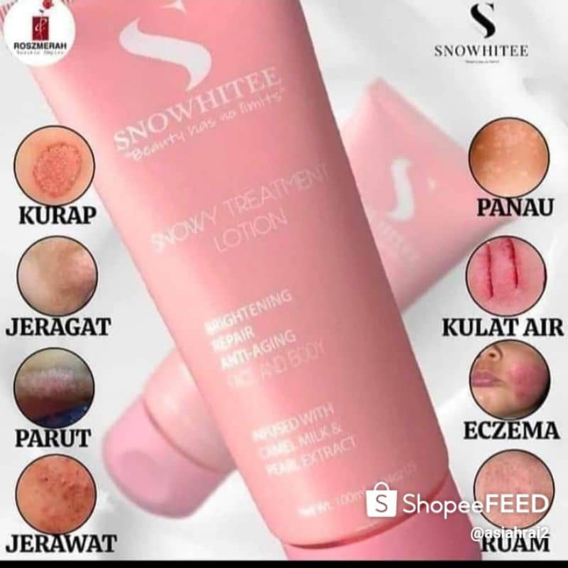 SNOW WHITE Treatment Lotion (penyakit kulit) Shopee Malaysia