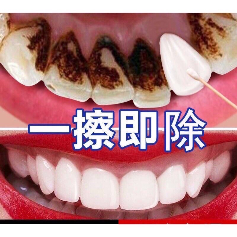 PEMUTIH GIGI YABANJING, Teeth whitening, putihkan gigi kuning dan hitam