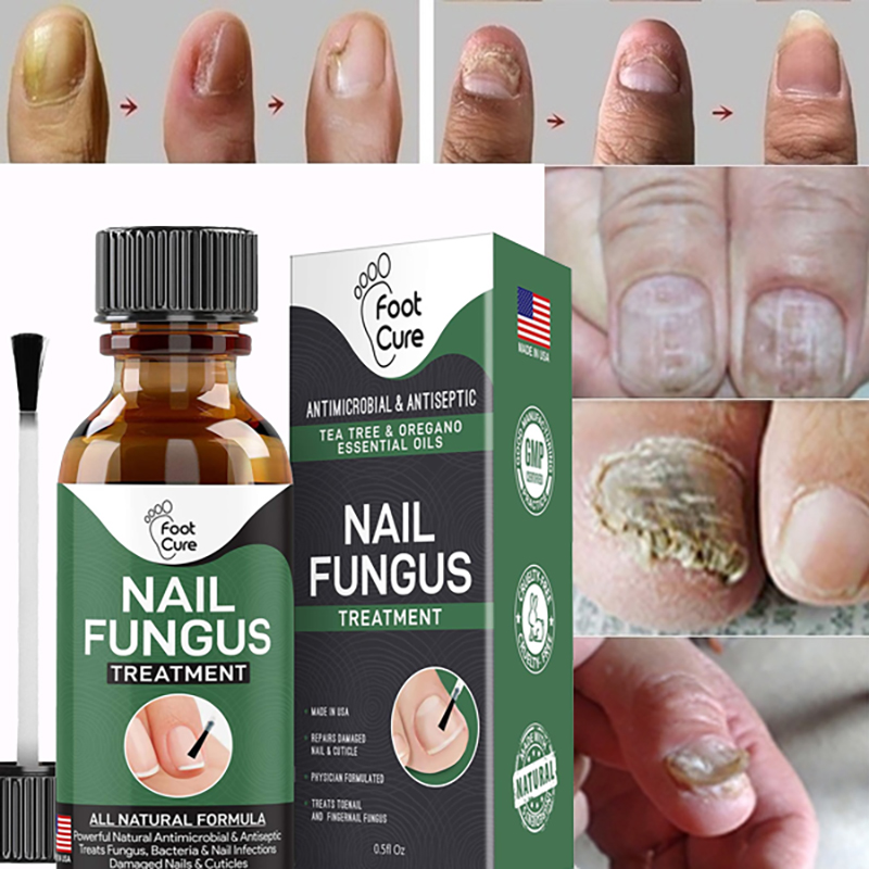 EXTRA STRONG Nail Fungus Treatment, Best Nail Repair, Stop Fungal