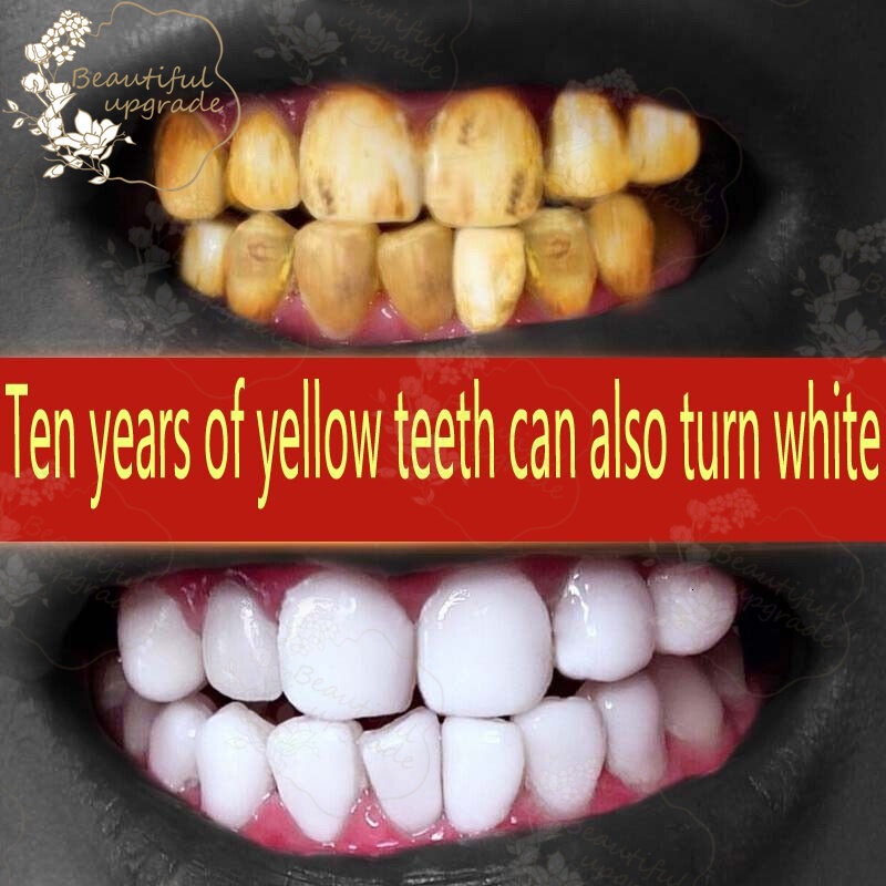 Probiotic whitening toothpaste Prevent tooth decay Protect the gums
