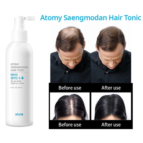 Saengmodan Hair Tonic 200ml from Korea Shopee Malaysia