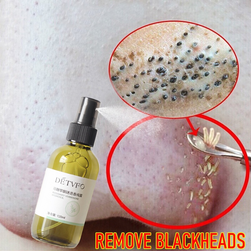 blackhead remover acne remover pimple black heads remover pore