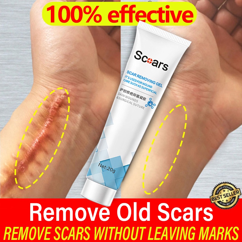 Scar Removal Cream Peklat Remover Scar Gel Acne Treatment scar remover