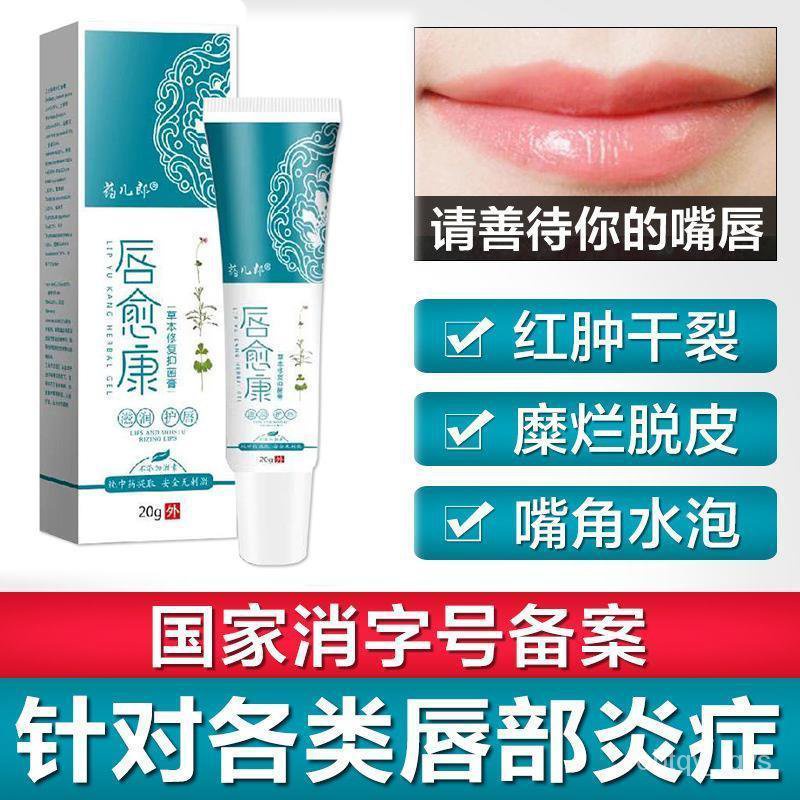 Cheilitis Cream Dry Lips and Cracked Lips Inflammation Allergic Angular