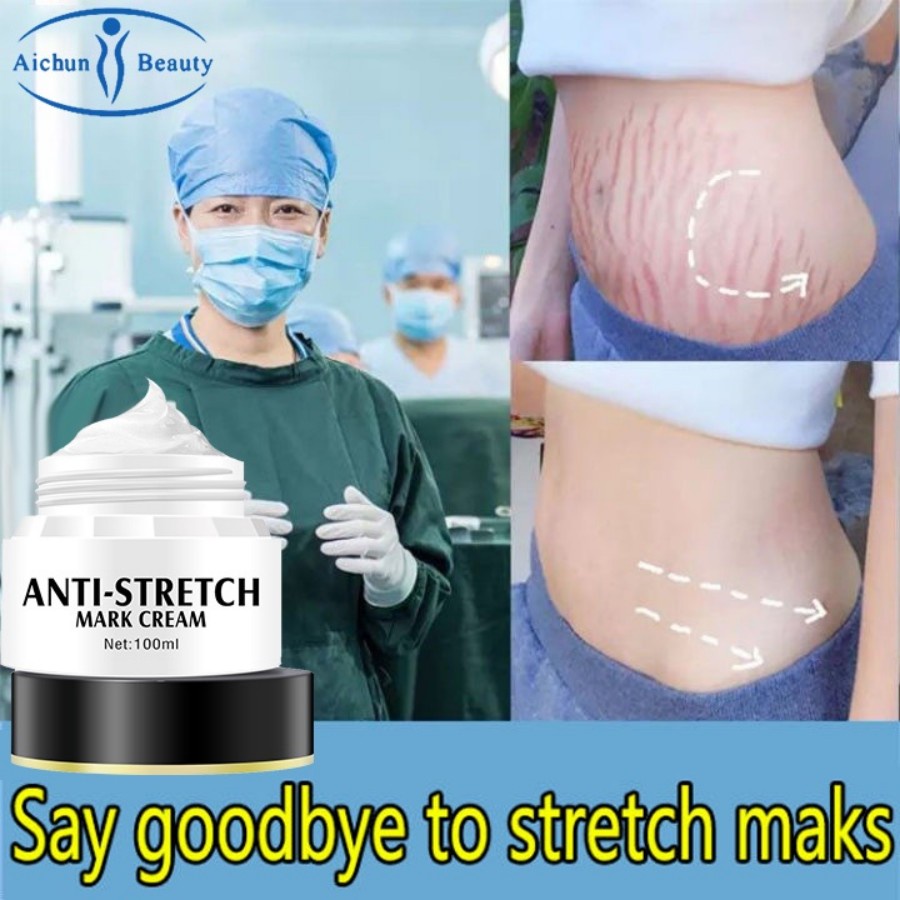 Stretch Mark Pimple Lotion Stretch Whitening Contractubex Body Pregnant Woman Bio Oil Scar