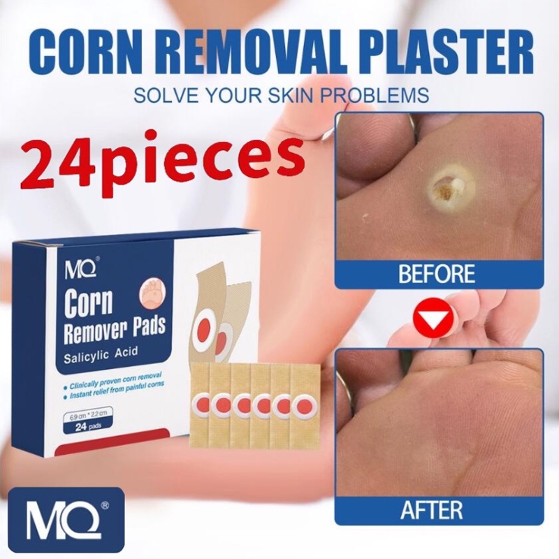 COD 24pcs Warts Remover Foot Corn Pads treatment first aid removal pain