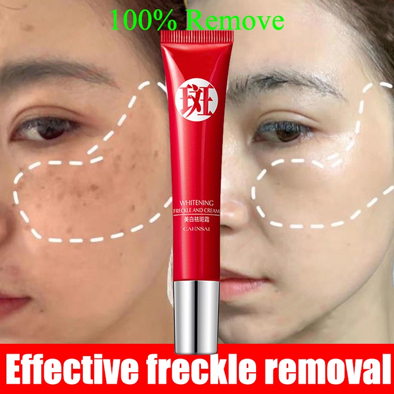 Whitening Freckle Cream Effective Remove Melasma Acne Dark Spot Moisturizing Skin Care 20g