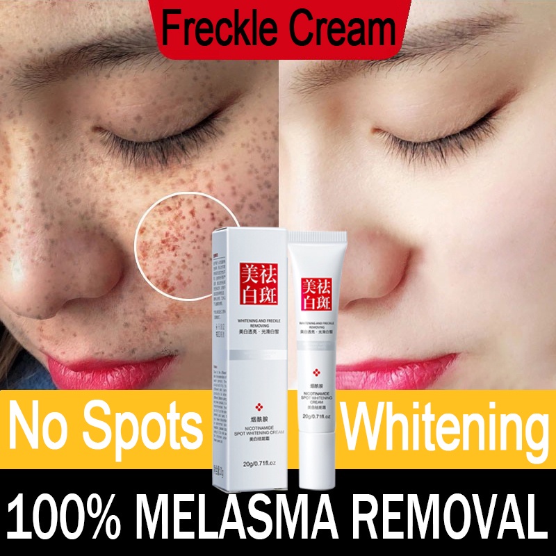 Effective Freckle Removal Whitening Cream Melasma Removal Cream Anti Melasma And Dark Spots