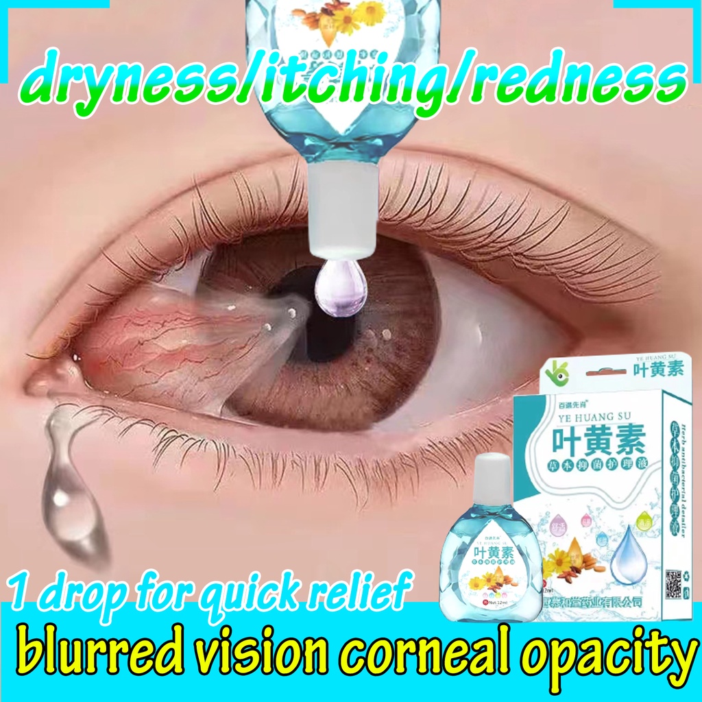 contactlens ☚Eye Drop 15gitchy PugitaDry EyesSore