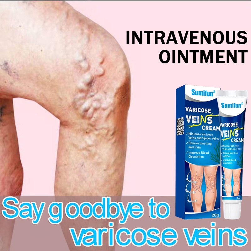 HOT!! Sumifun VARICOSE VEING CREAM aricose Veins Cream Intravenous
