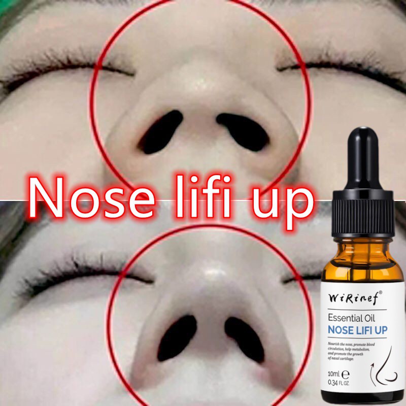 castor oil [Ready Stock] Nose up Essential Oil Nose Lifting Beauty