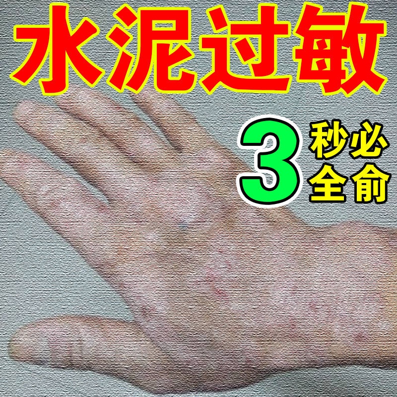 【Itching】Cement allergy and antiitch cream, peeling, dry, cracked