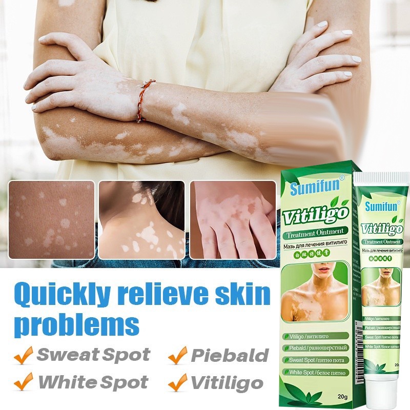 Vitiligo Cream Vitiligo Treatment Cream White Spots Tag / Kulugo