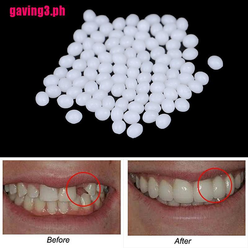 [Gavingph]Temporary Tooth Repair KitThermal Beads Fix the Missing