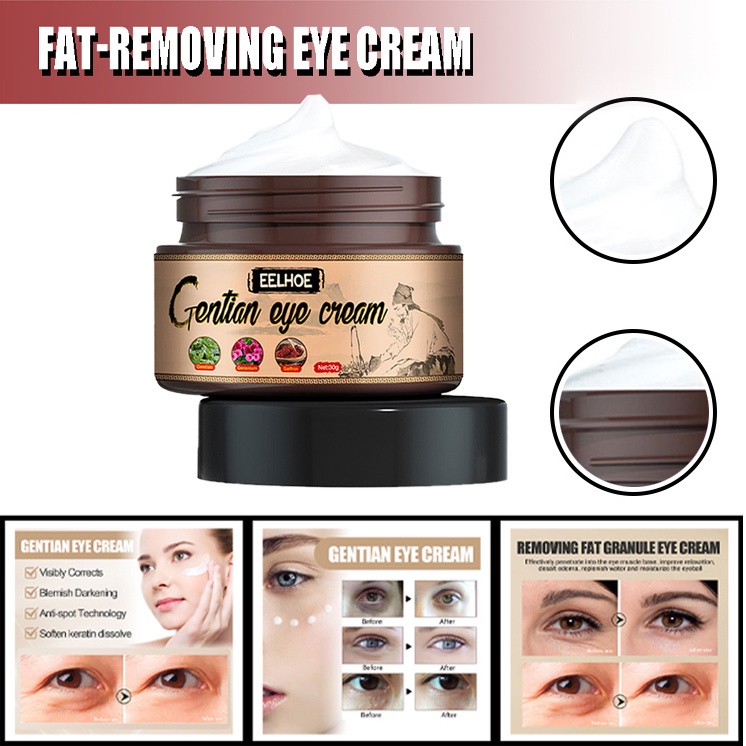 Gentian Milia Remover Eye Cream for Milia Spot Treatment Soften skin Shopee Philippines