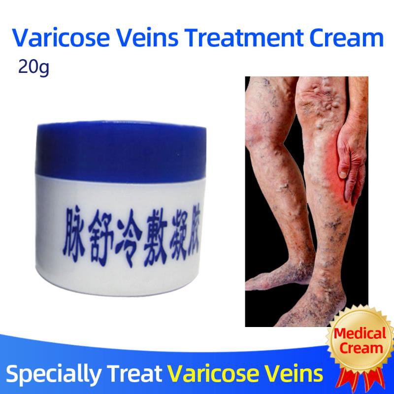 Herbal Medicine for Treating Varicose Vasculitis Phlebitis Spider Legs
