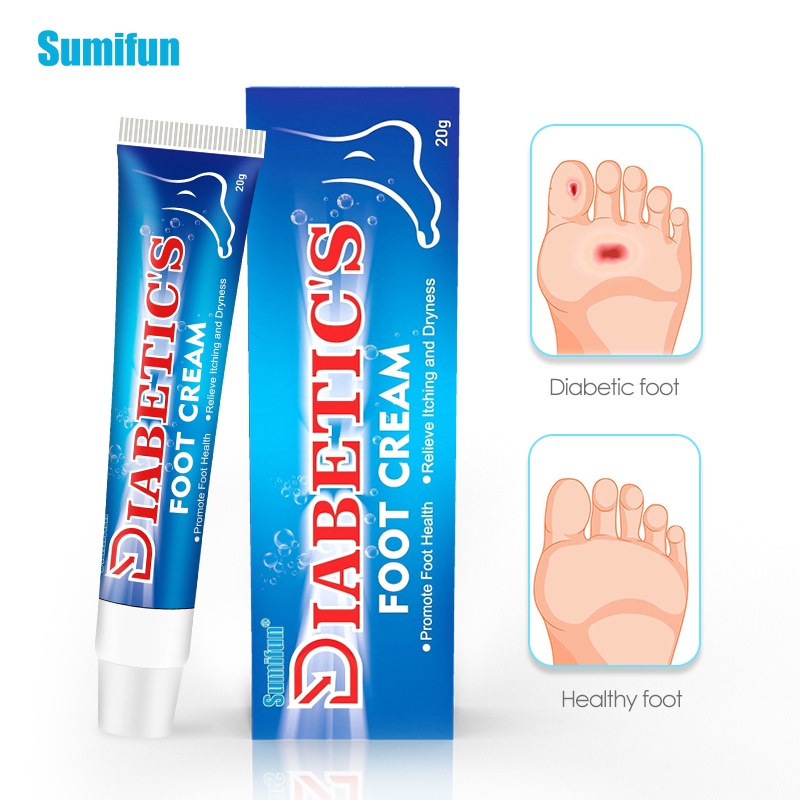 1Pc Sumifun Diabetic Foot Treatment Cream Anti Inflammation Foot Ulceration Beriberi Cream Itch