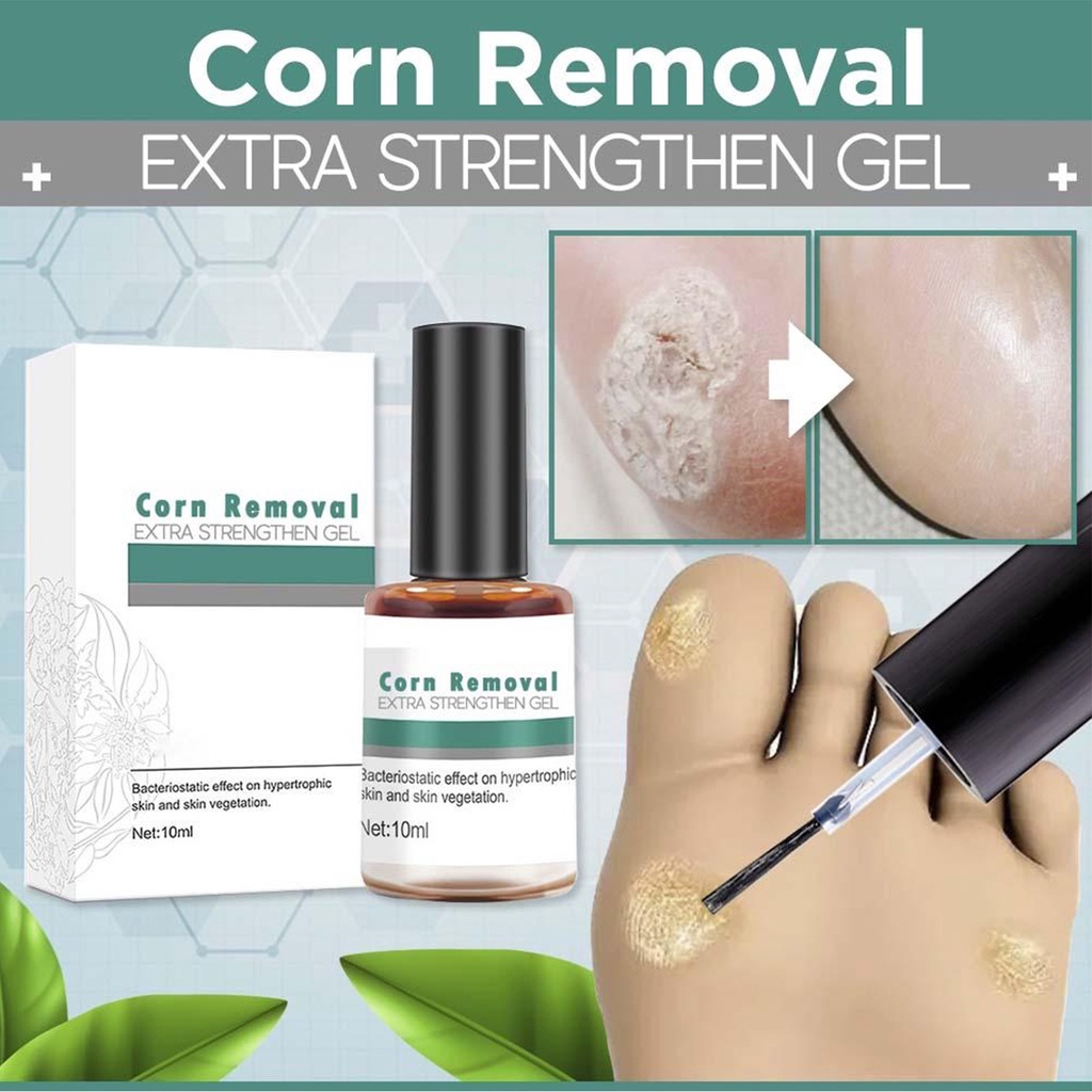 Corns Removal Solution Warts Calluses Removal Solution Warts Thorn