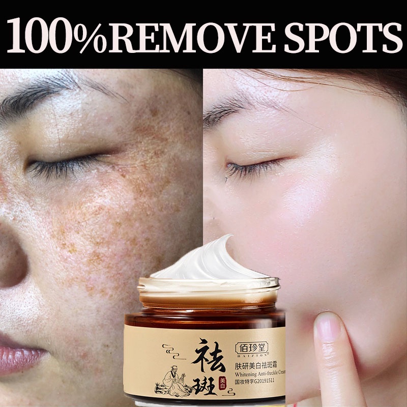 removal blackheads nose ♔100g Korea Genuine Whitening Freckle Cream dark spots remover Anti