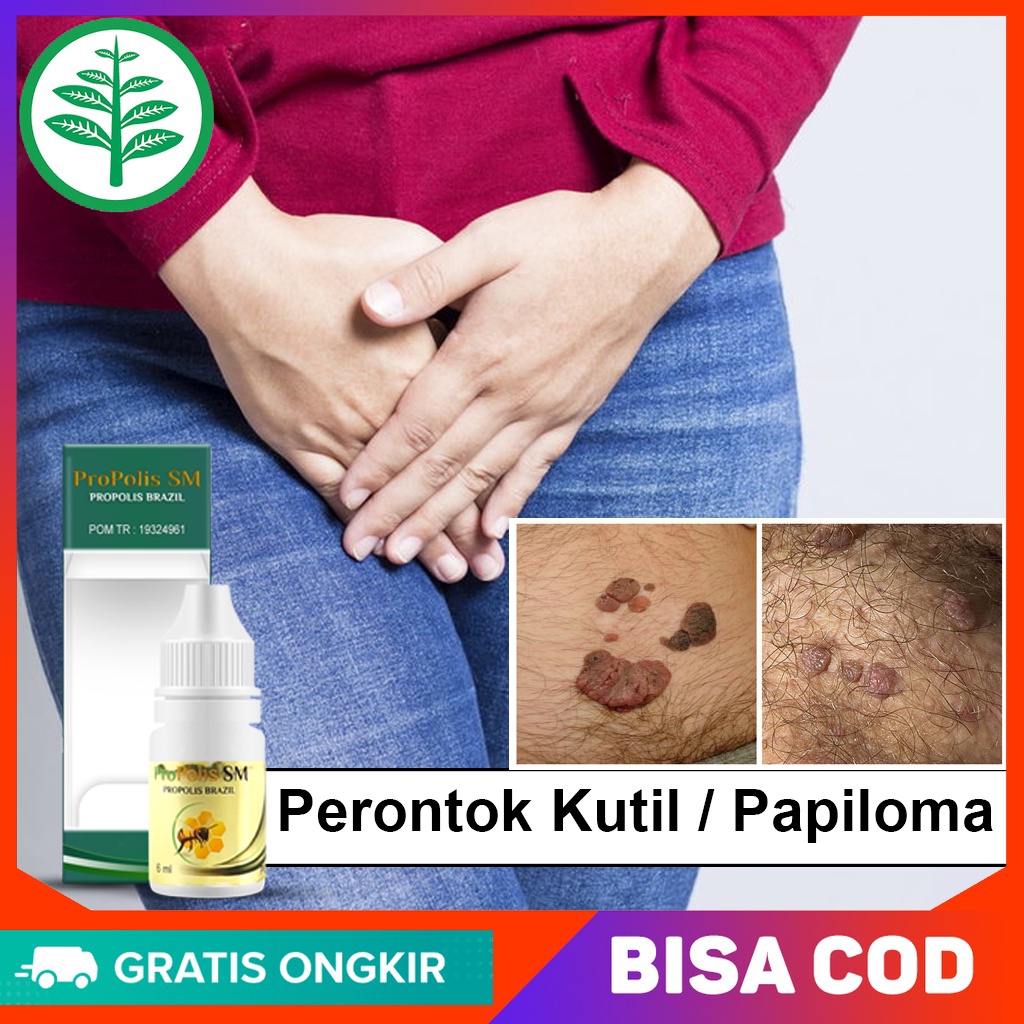 Kelamine Wart Medicine Medicine Ointment / Bristles For Tags