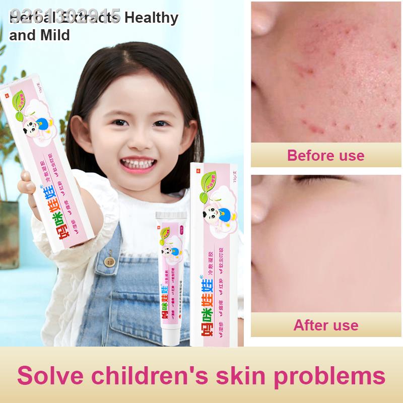 Eczema Treatment Cream For Baby 15g Rashes Cream For Baby Soothing No