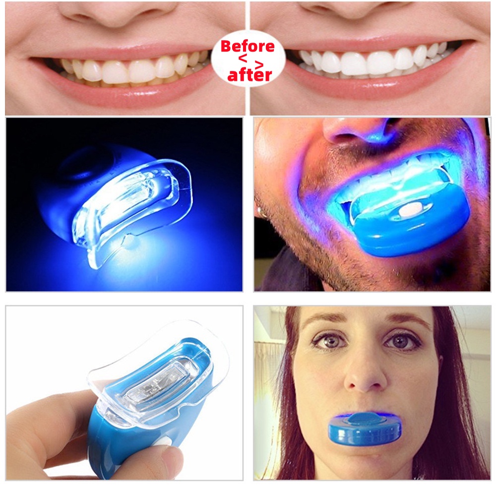 LED Teeth Whitening Device Dental Treatment Health Oral Care Blue Light