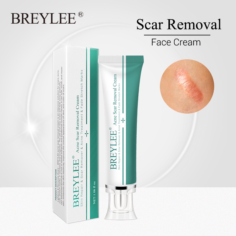 BREYLEE Acne Scar Removal Cream 30g Face Cream Skin Repair Skin Care