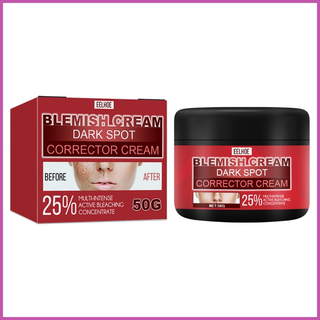 AntiDark Spot Fade Cream Hyperpigmentation Treatments Dark Spot