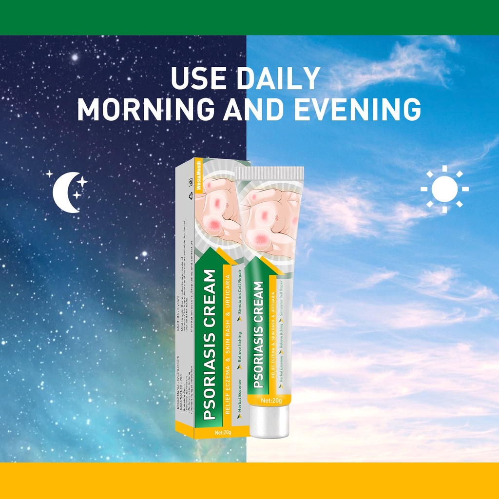 West&Month Psoriasis Cream Skin Scalp Ringworm Psoriasis Inner Thigh
