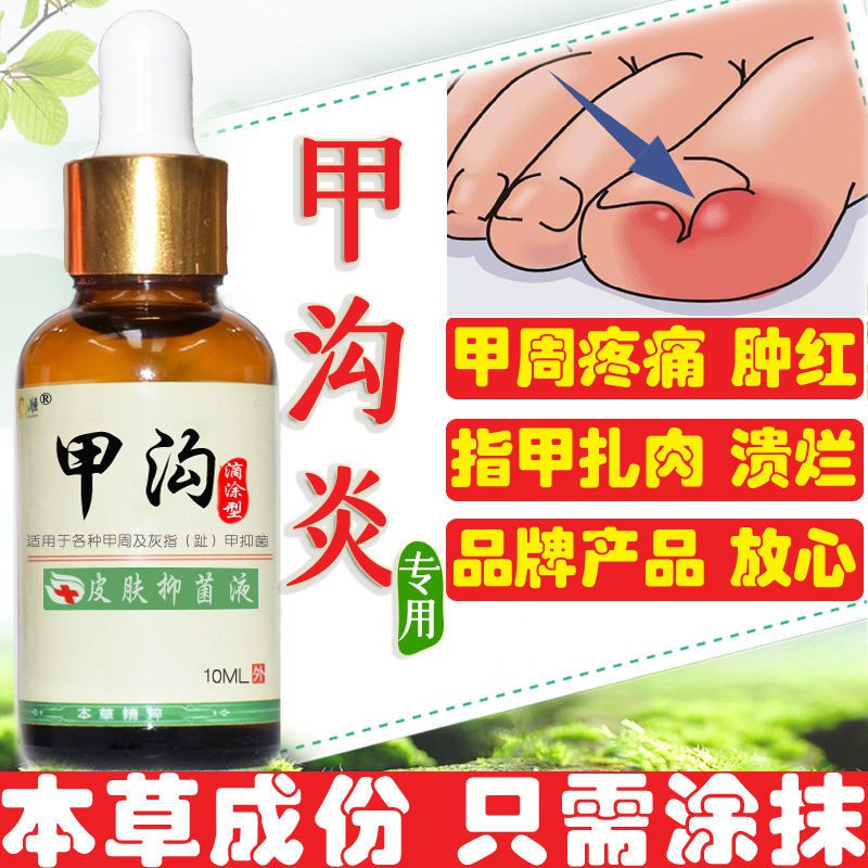 [Special ointment for paronychia] [No need to pull nails, no pain