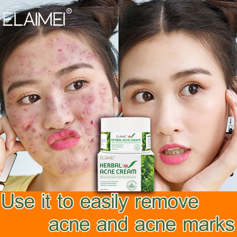 ELAIMEI pimple eraser pimple erase serum,pimple marks and dark spots