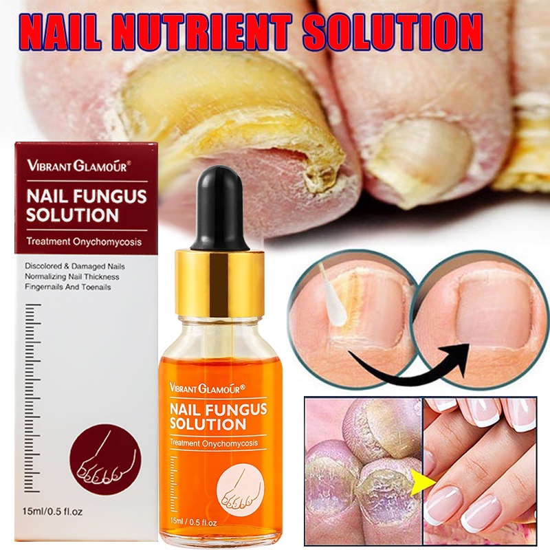Nail Repair Serum Fungal Nail Treatment Essence Remove Onychomycosis Toe Nourishing Skin Care