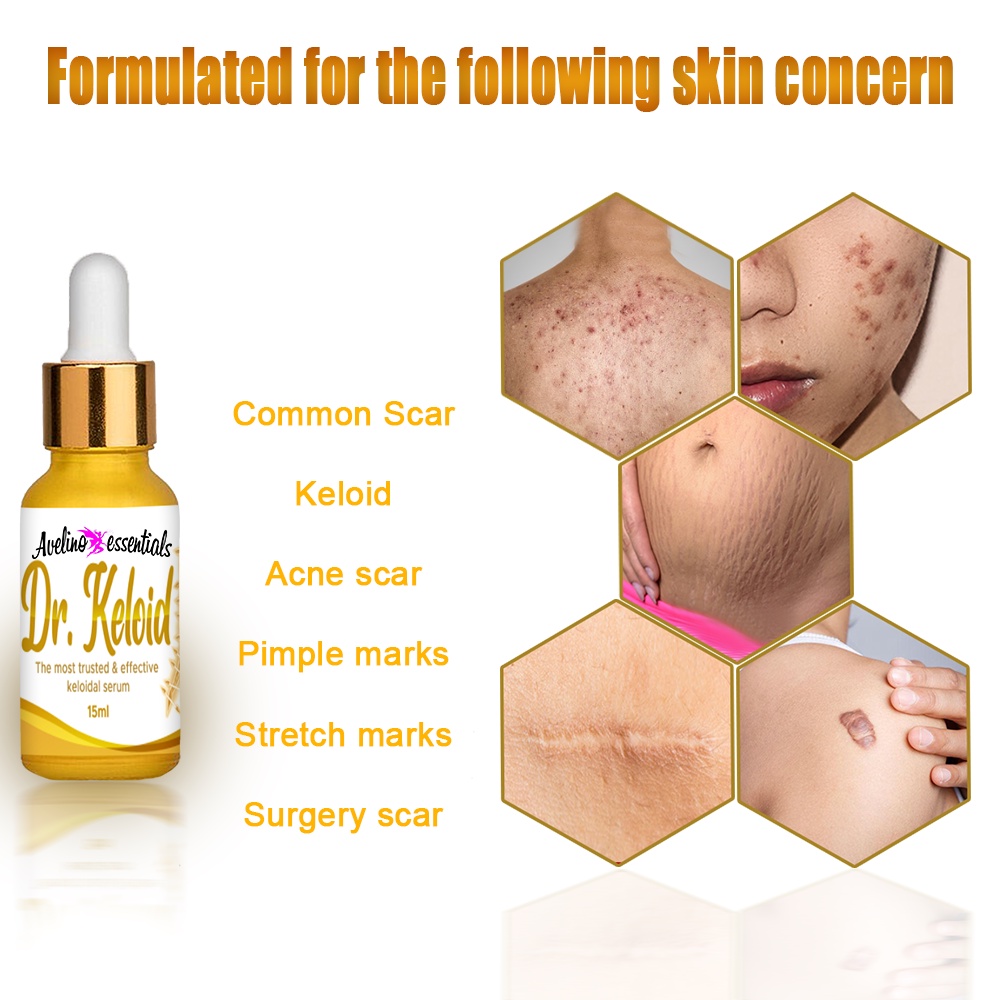 DR KELOID scar and keloid remover by Avelino Essential , keloid remover