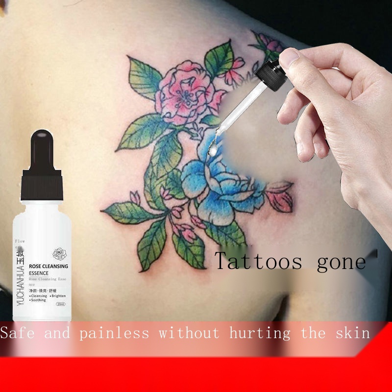 Removal of tattoos to remove tattoo potions quickly to remove tattoos