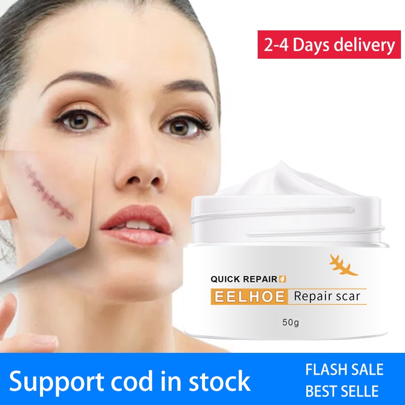 ♂ Effective Best Scar Remover Cream Stretch Mark Remover Anti Acne Scars Removal Whitening Skin