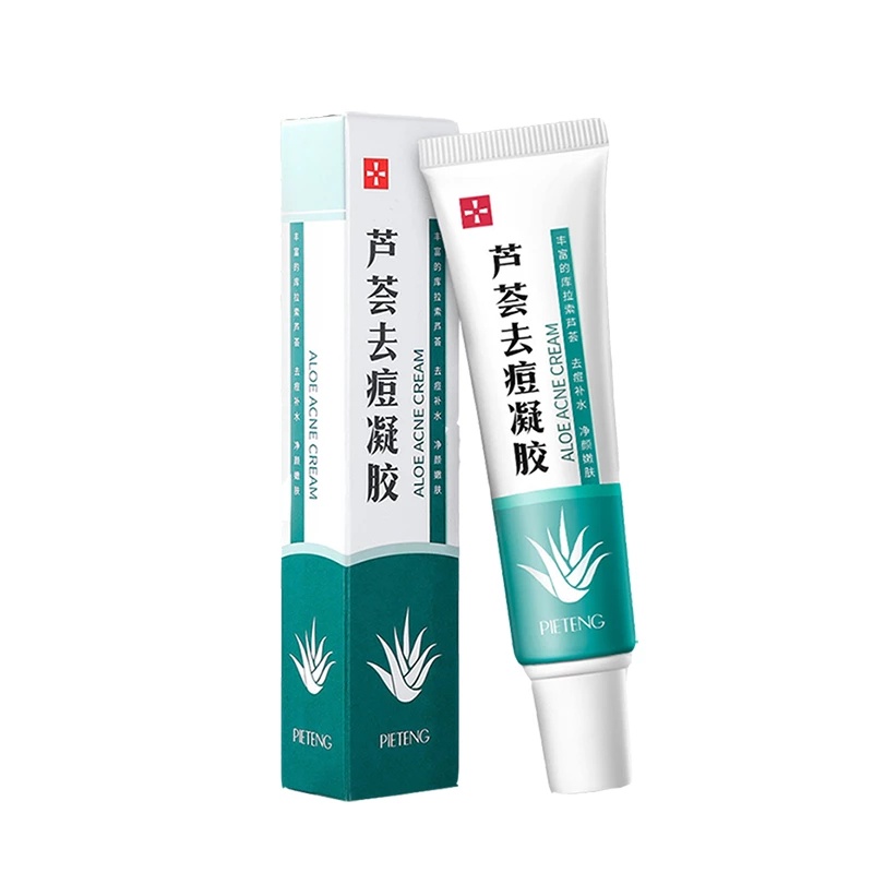 Aloe Vera Acne Removal Cream Fade Acne Spots Scar Marks Oil Control Whitening Moisturizing Skin