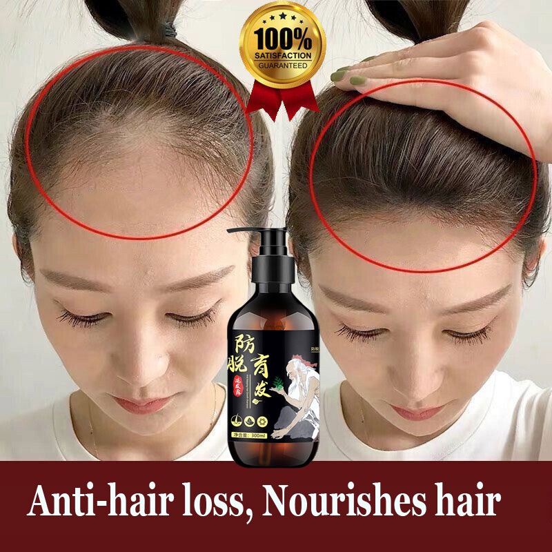 300ml New Ginger Hair Growth Shampoo Anti Hair Loss Antidandruff