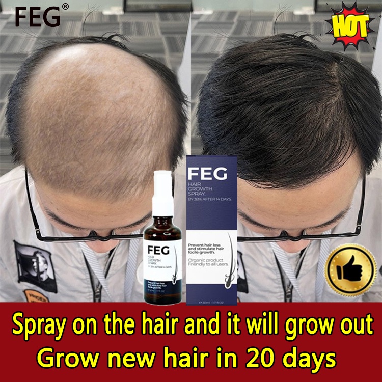 FEG Hair Growth Spray 50ml Rapid hair growth spray once in the morning