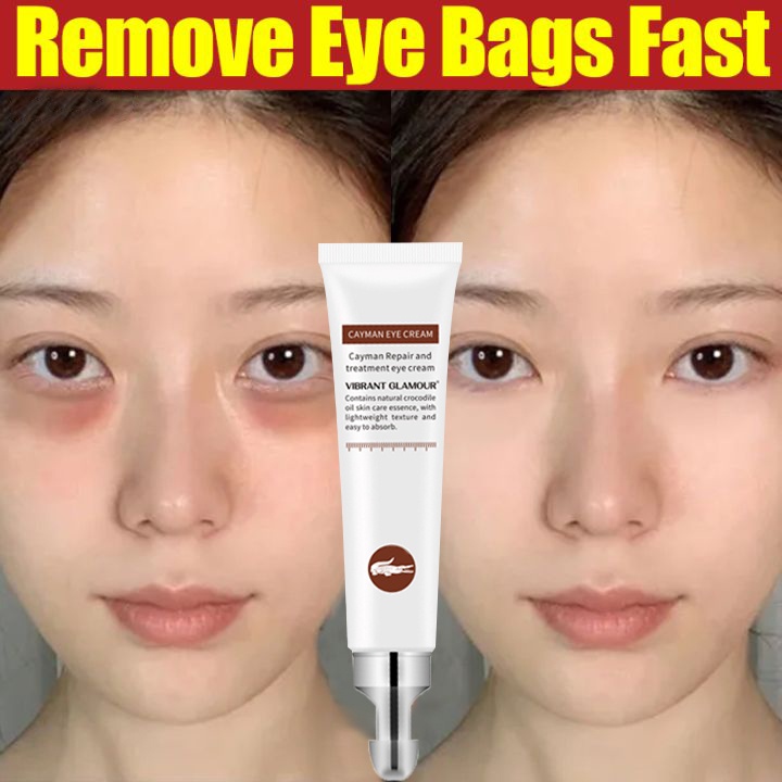 Eye Cream for Dark Circle Eyebag Dark Circle Remover Cream Eye Bags